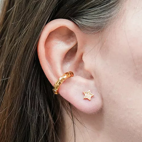 Par de topos star filled with zircons